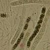 lividum