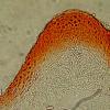 episphaeria