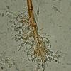 polyblastia