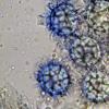 cerebriformis