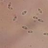 irregularis