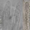 sclerotiorum