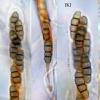 rubronotata