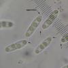 erythrostigma