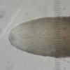 hystrix