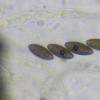 leptospora