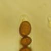 subcutanea