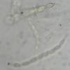 anceps