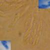 hypothallina