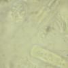 cryptospora