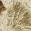porothelia