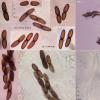 leptospora