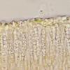 subsphaerospora