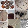 orbicularis