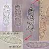 platanoidis