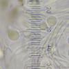sphaerosporum