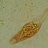nigroannulata