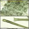 fusisporum