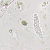 xylophilus