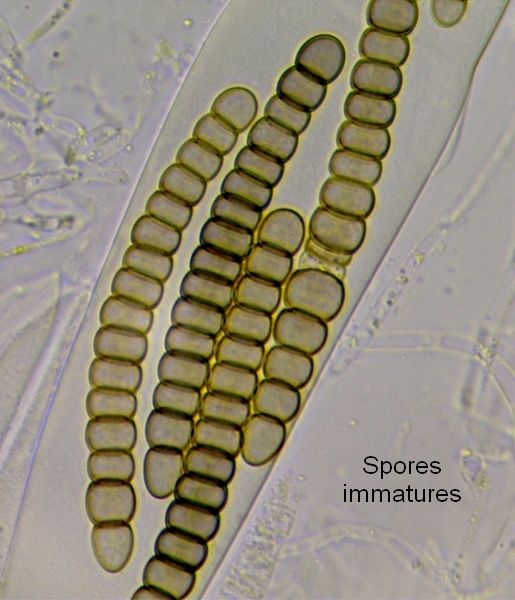 macrostoma