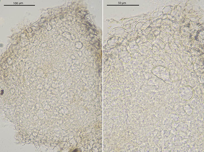 macrostoma