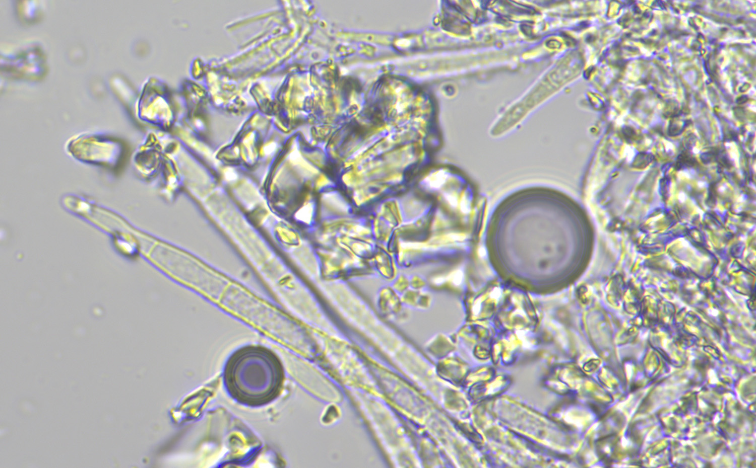 macrostoma