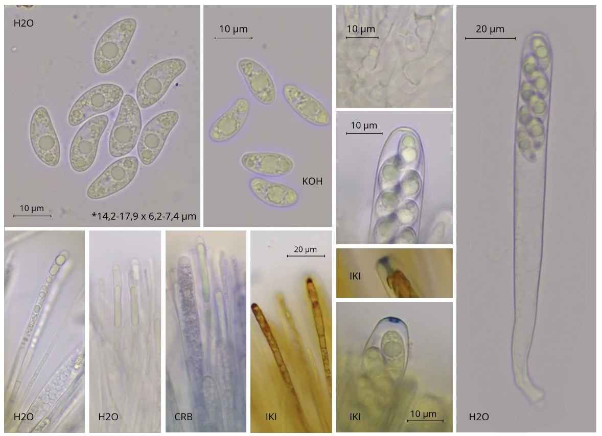 macrostoma