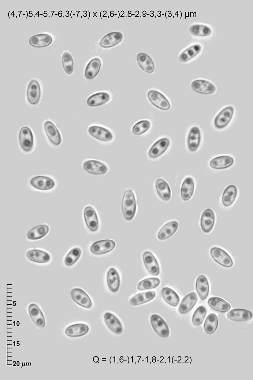 macrostoma