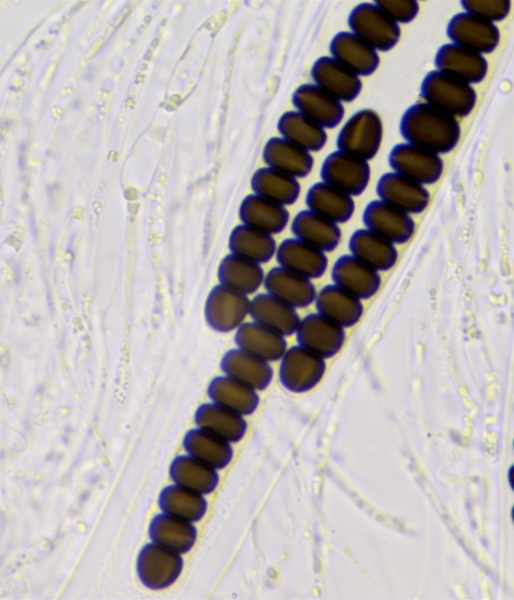 macrostoma